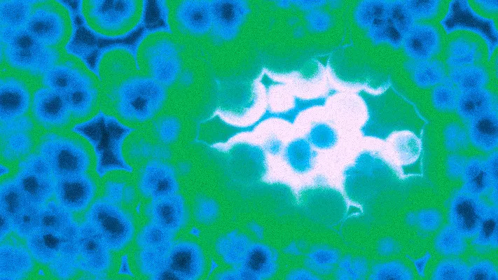 LGV Lymphogranuloma Venereum Treatment in Singapore
