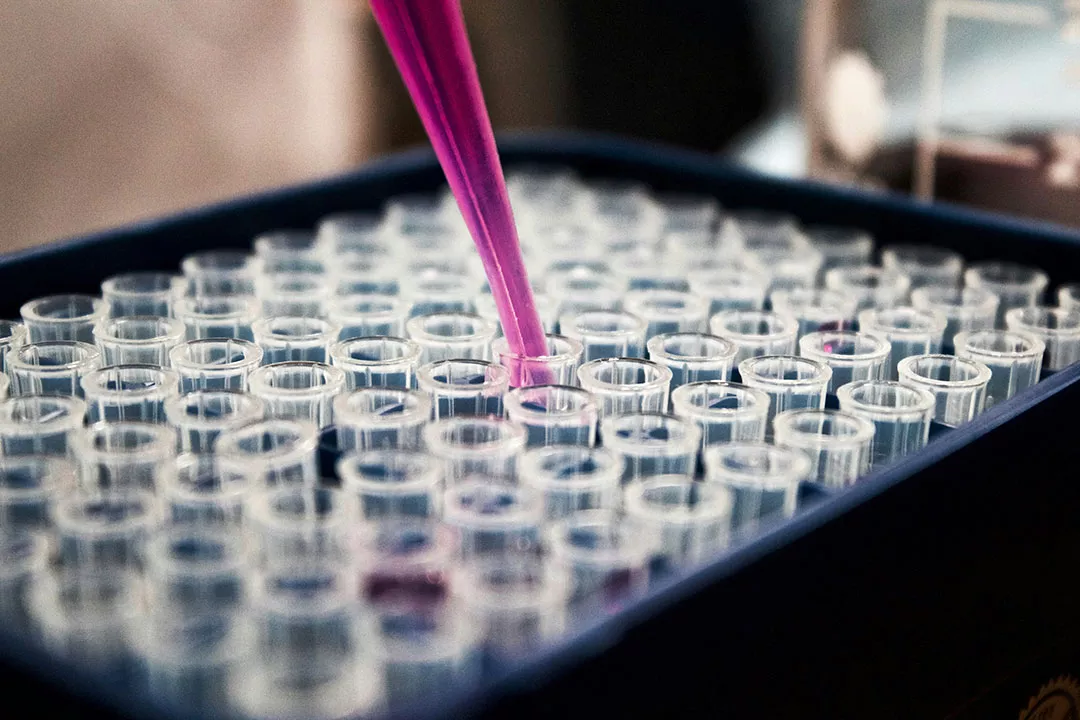 Fetomaternal Bleed, Flow Cytometry, Blood Fetomaternal Bleed, Flow Cytometry, Blood