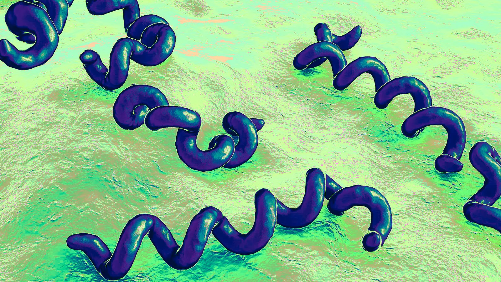 Stages of Syphilis