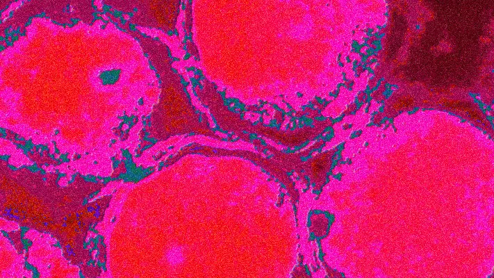 Lymphogranuloma venereum LGV treatment guidelines
